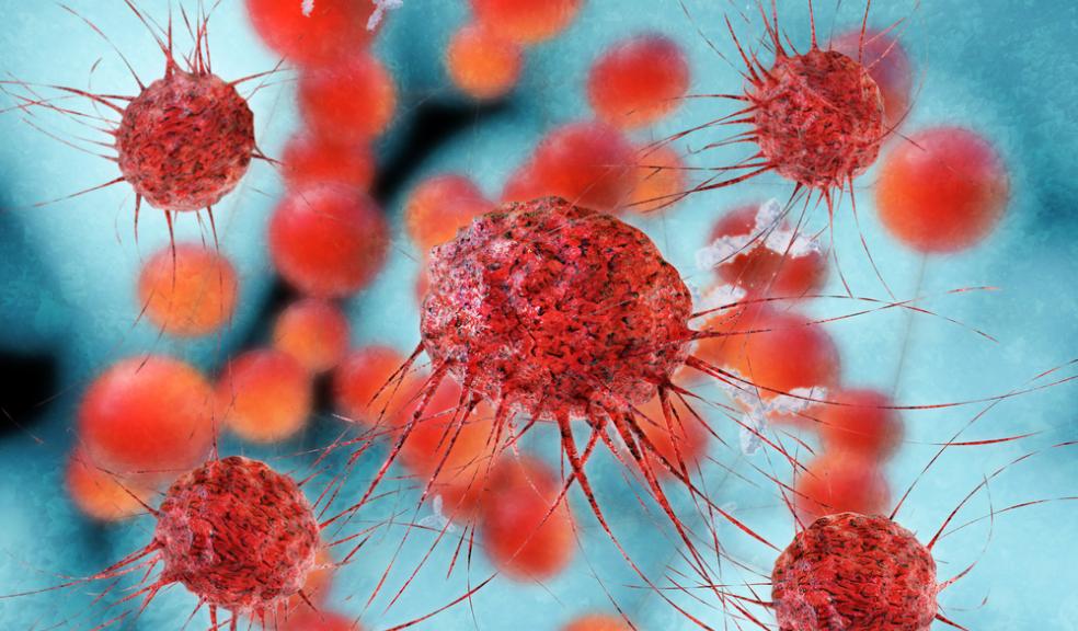 Can A Ca125 Blood Test Detect Ovarian Cancer